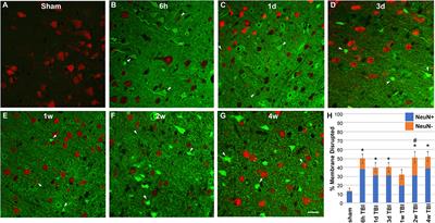 Neuronal Membrane Disruption Occurs Late Following Diffuse <mark class="highlighted">Brain Trauma</mark> in Rats and Involves a Subpopulation of NeuN Negative Cortical Neurons